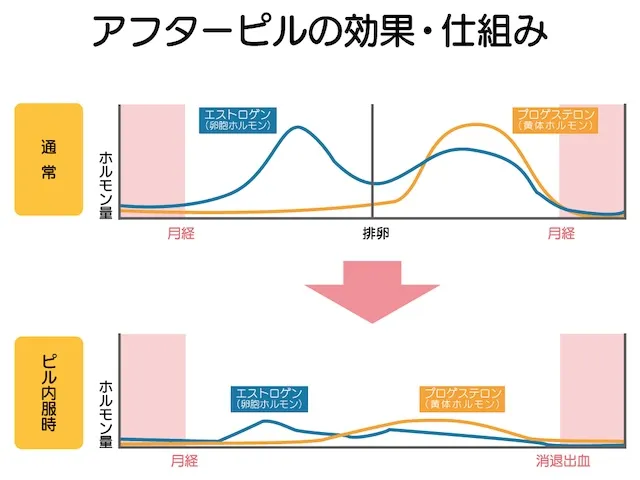 アフターピルの効果・仕組み